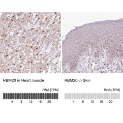 RBM20 Antibody, Novus Biologicals 25 &mu;L, Unlabeled:Antibodies, Polyclonal